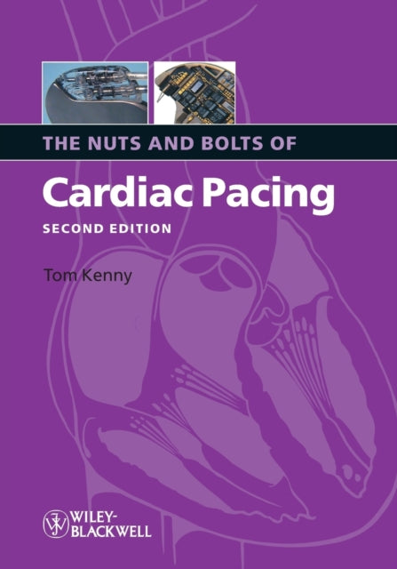 Book cover of: Nuts and Bolts of Cardiac Pacing. By: Kenny, Tom