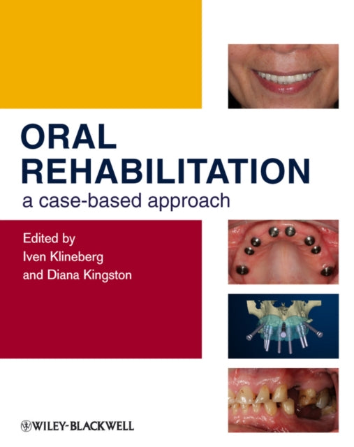 Book cover of: Oral Rehabilitation. By: Iven Klineberg