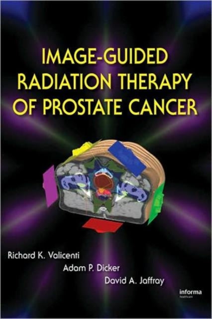 Book cover of: Image-Guided Radiation Therapy of Prostate Cancer