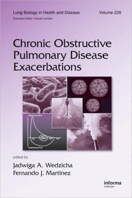 Book cover of: Chronic Obstructive Pulmonary Disease Exacerbations