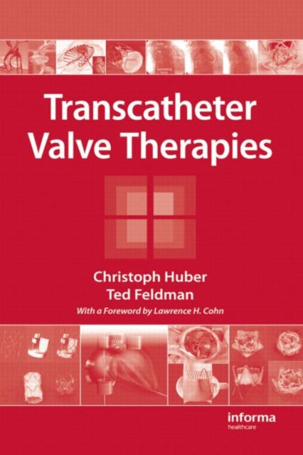 Book cover of: Transcatheter Valve Therapies. By: Christoph Huber