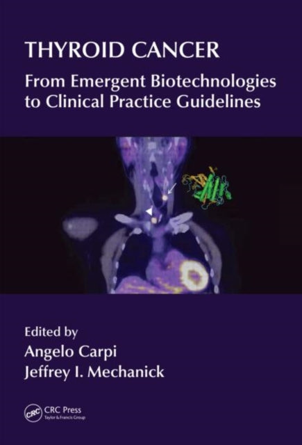 Book cover of: Thyroid Cancer. By: A. Carpi