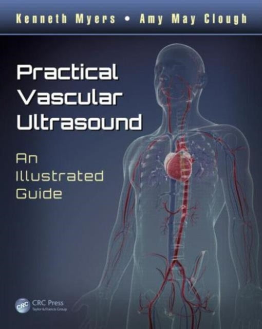 Book cover of: Practical Vascular Ultrasound. By: Kenneth Kenneth