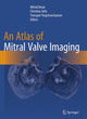 Book cover of: Atlas of Mitral Valve Imaging. By: Milind Desai