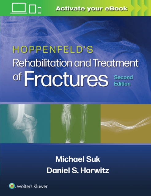 Book cover of: Hoppenfeld's Treatment and Rehabilitation of Fractures. By: Suk