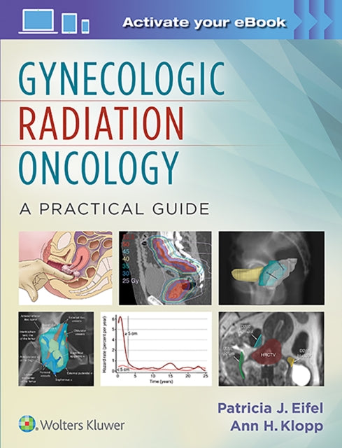 Book cover of: Gynecologic Radiation Oncology: A Practical Guide. By: Patricia Eifel
