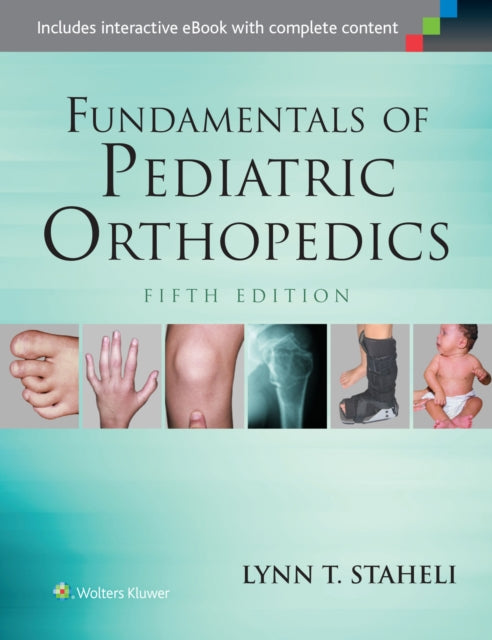 Book cover of: Fundamentals of Pediatric Orthopedics. By: Lynn T. Staheli MD