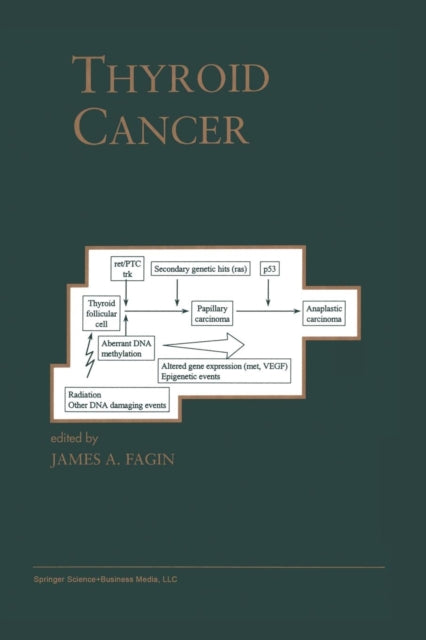 Book cover of: Thyroid Cancer. By: James A.Fagin