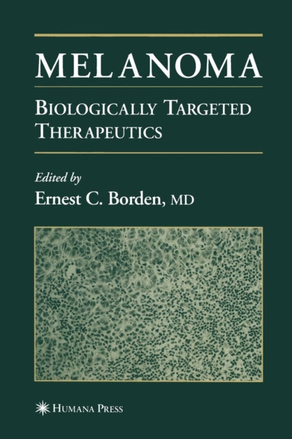 Book cover of: Melanoma. By: Ernest C. Borden