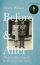 Book cover of: Before & After. By: Alison Wilson