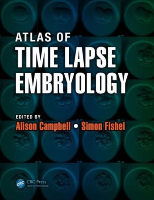 Book cover of: Atlas of Time Lapse Embryology. By: Simon Fishel