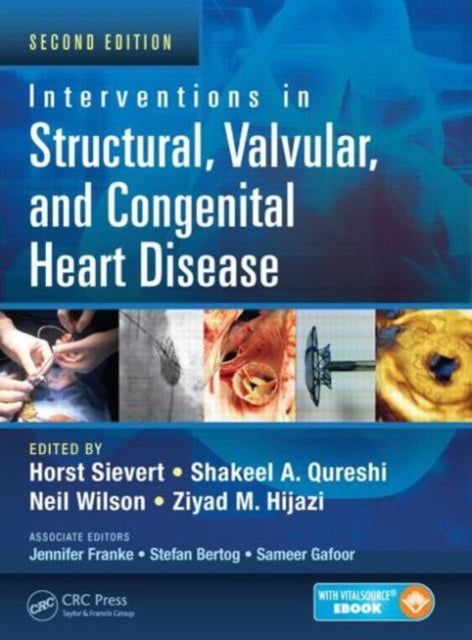 Book cover of: Interventions in Structural, Valvular and Congenital Heart Disease. By: Horst Sievert