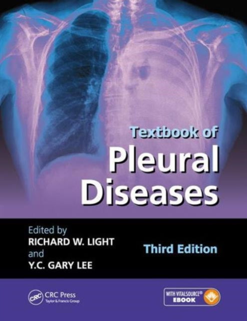 Book cover of: Textbook of Pleural Diseases. By: Richard W. Light