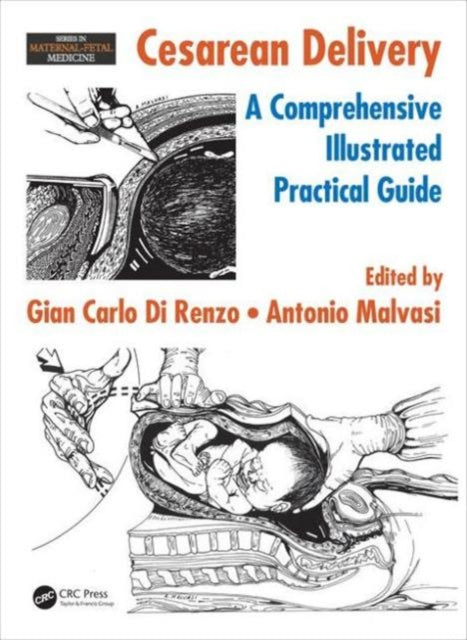 Book cover of: Cesarean Delivery. By: Gian Carlo Di Renzo