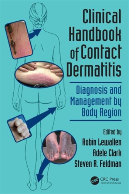 Book cover of: Clinical Handbook of Contact Dermatitis. By: Robin Lewallen