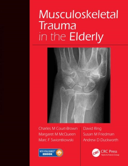 Book cover of: Musculoskeletal Trauma in the Elderly. By: Charles M. Court-Brown