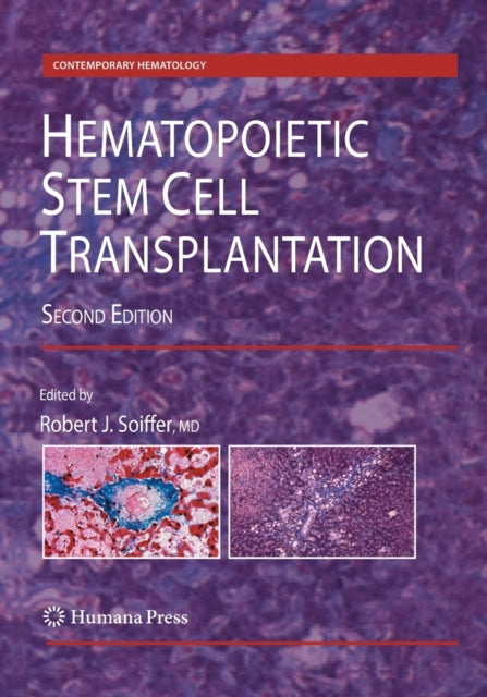 Book cover of: Hematopoietic Stem Cell Transplantation. By: Robert J. Soiffer