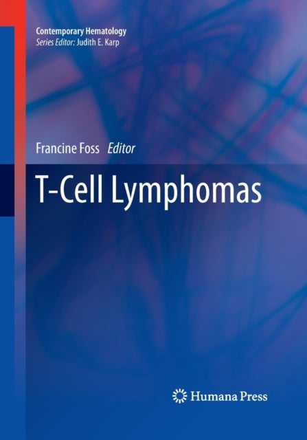 Book cover of: T-Cell Lymphomas. By: Francine Foss