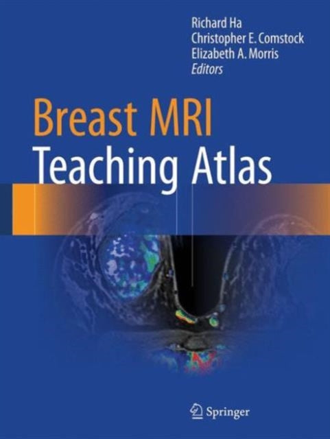 Book cover of: Breast MRI Teaching Atlas. By: Richard Ha