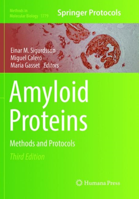 Book cover of: Amyloid Proteins. By: Einar M. Sigurdsson