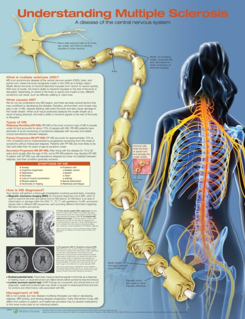 Book cover of: Understanding Multiple Sclerosis Anatomical Chart. By: Anatomical Chart Company
