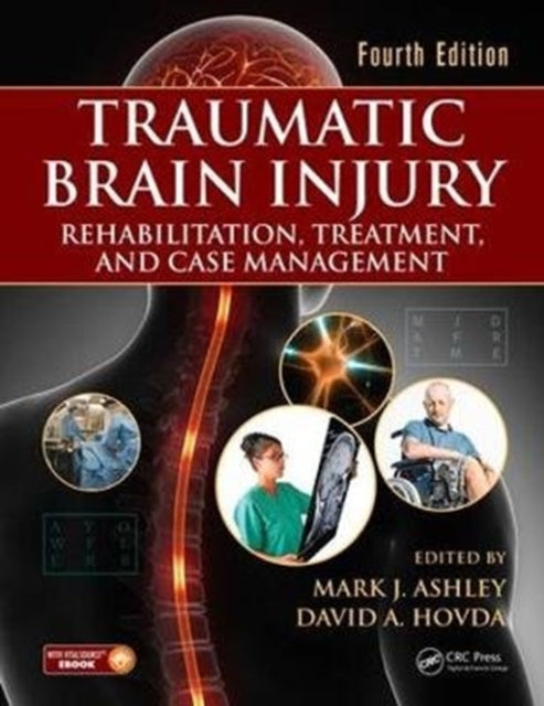 Book cover of: Traumatic Brain Injury. By: Mark J. Ashley