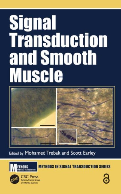 Book cover of: Signal Transduction and Smooth Muscle. By: Mohamed Trebak