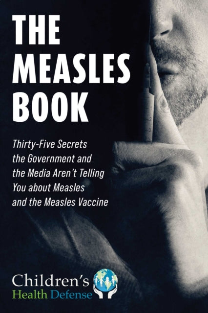 Book cover of: Measles Book. By: Children's Health Children's Health Defense