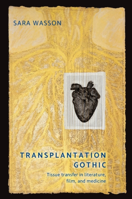 Book cover of: Transplantation Gothic. By: Sara Wasson