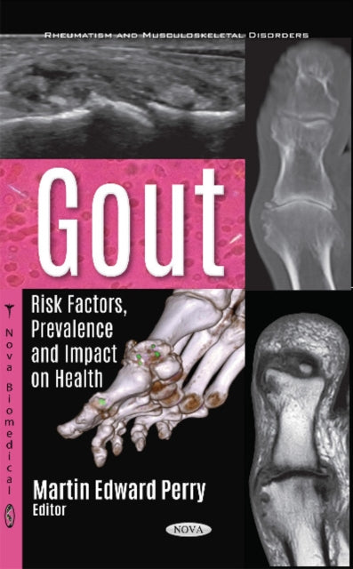 Book cover of: Gout. By: Martin Edward Perry