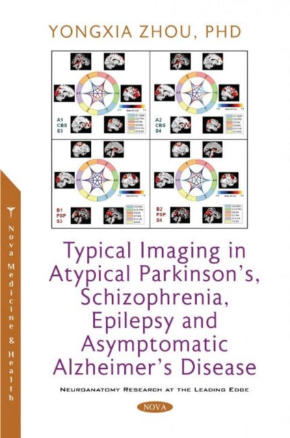 Book cover of: Typical Imaging in Atypical Parkinson's, Schizophrenia, Epilepsy and Asymptomatic Alzheimer's Disease. By: Yongxia Zhou