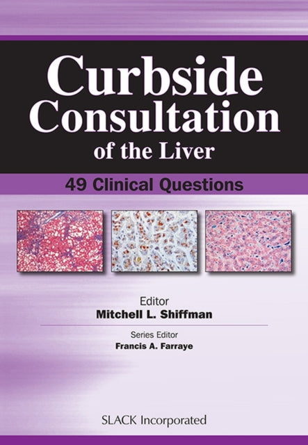 Book cover of: Curbside Consultation of the Liver