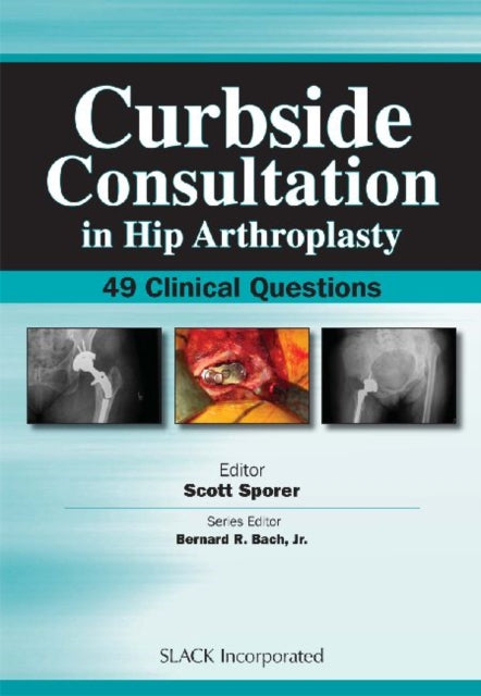 Book cover of: Curbside Consultation in Hip Arthroplasty