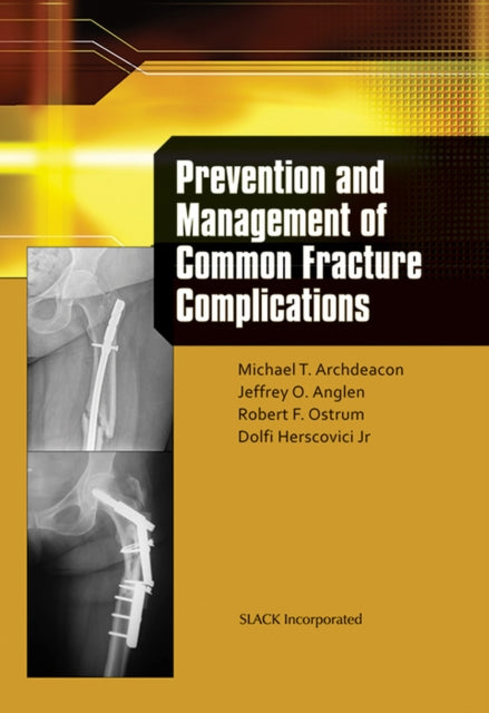 Book cover of: Prevention and Management of Common Fracture Complications. By: Michael T. Archdeacon