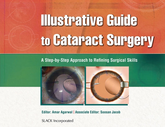 Book cover of: Illustrative Guide to Cataract Surgery. By: Amar Agarwal