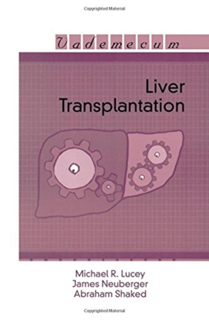 Book cover of: Liver Transplantation. By: Michael R. Lucey