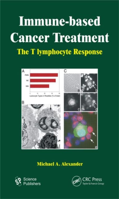 Book cover of: Immune-based Cancer Treatment. By: Michael A. Alexander