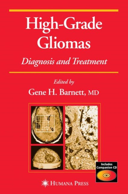 Book cover of: High-Grade Gliomas. By: Gene H. Barnett