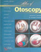 Book cover of: Atlas of Otoscopy. By: Joseph B., Ph.D. Touma