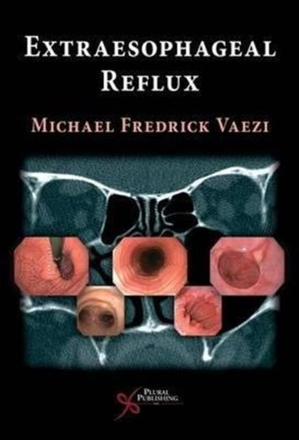 Book cover of: Extra Esophageal Reflux. By: Michael Vaezi