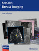 Book cover of: Radcases Breast Imaging. By: Lonie L. Salkowski