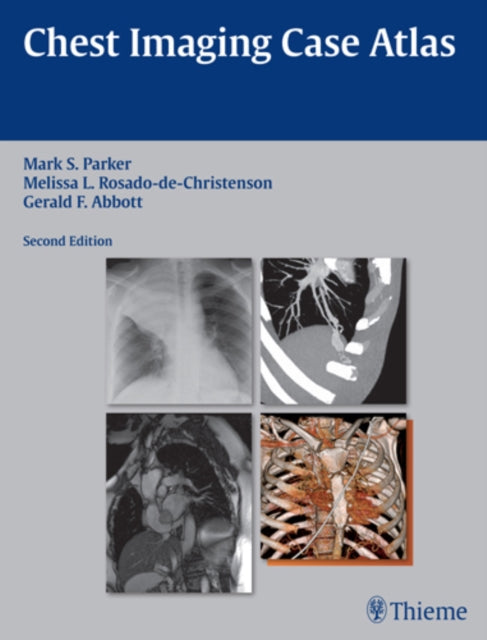 Book cover of: Chest Imaging Case Atlas. By: Mark S. Parker