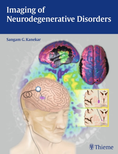 Book cover of: Imaging of Neurodegenerative Disorders. By: Sangam Kanekar