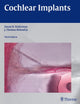 Book cover of: Cochlear Implants. By: Susan B. Waltzman