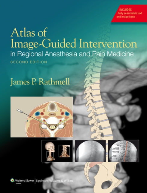 Book cover of: Atlas of Image-Guided Intervention in Regional Anesthesia and Pain Medicine. By: James P. Rathmell