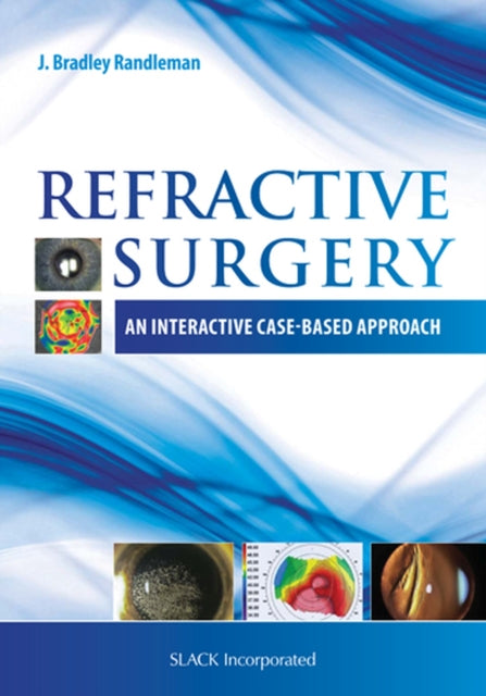 Book cover of: Refractive Surgery. By: J. Bradley Randleman MD