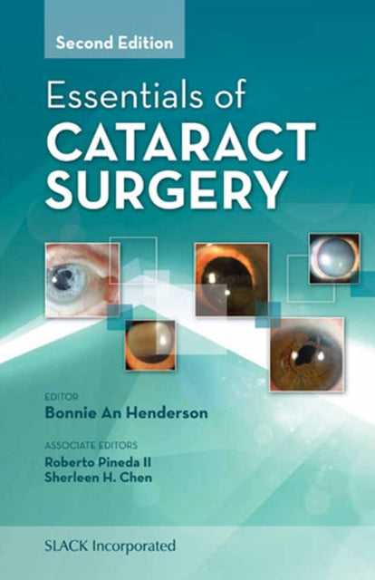 Book cover of: Essentials of Cataract Surgery. By: Bonnie An Henderson MD  FACS