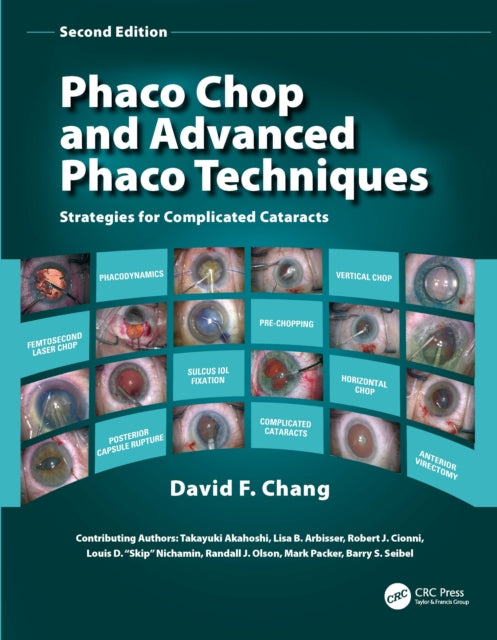 Book cover of: Phaco Chop and Advanced Phaco Techniques. By: David F. Chang MD