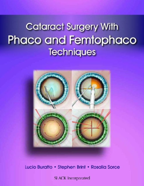 Book cover of: Cataract Surgery With Phaco and Femtophaco Techniques. By: Lucio Buratto