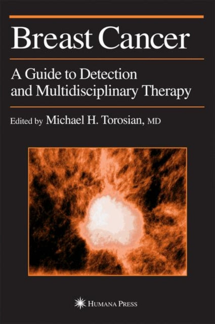 Book cover of: Breast Cancer. By: MD Michael H. Torosian